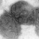 Gonorrhea, caused by the bacteria Neisseria gonorrhoeae, above, is a summertime disease, according to a new paper.